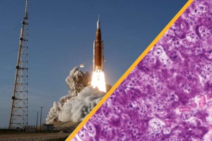 Artemis II стартовала, а учёные вылечили диабет 1‑го типа у мышей